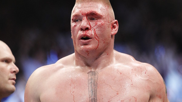 Brock Lesnar during his UFC heavyweight mixed martial arts title match against Shane Carwin Saturday, July 3, 2010, at The MGM Grand Garden Arena in Las Vegas. (AP Photo/Eric Jamison)
