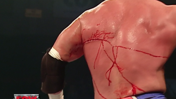 Triple H Injury