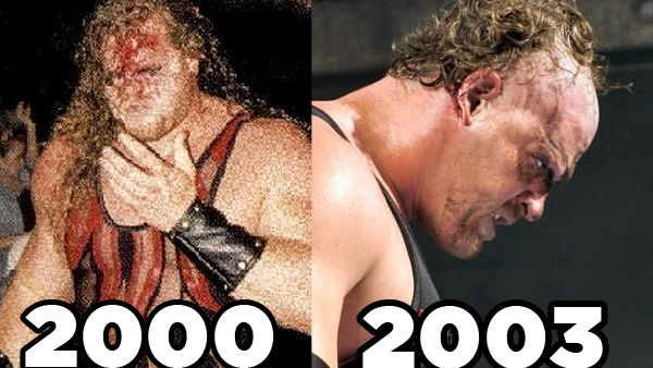 Kane Unmasking Years