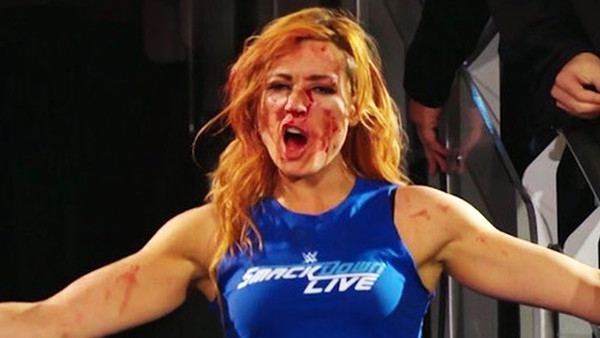 Who Busted Becky Lynch Open On Last Night S WWE Raw Thumb