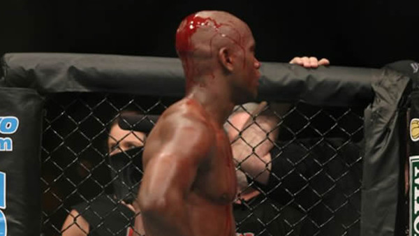 ufc bloodiest fight