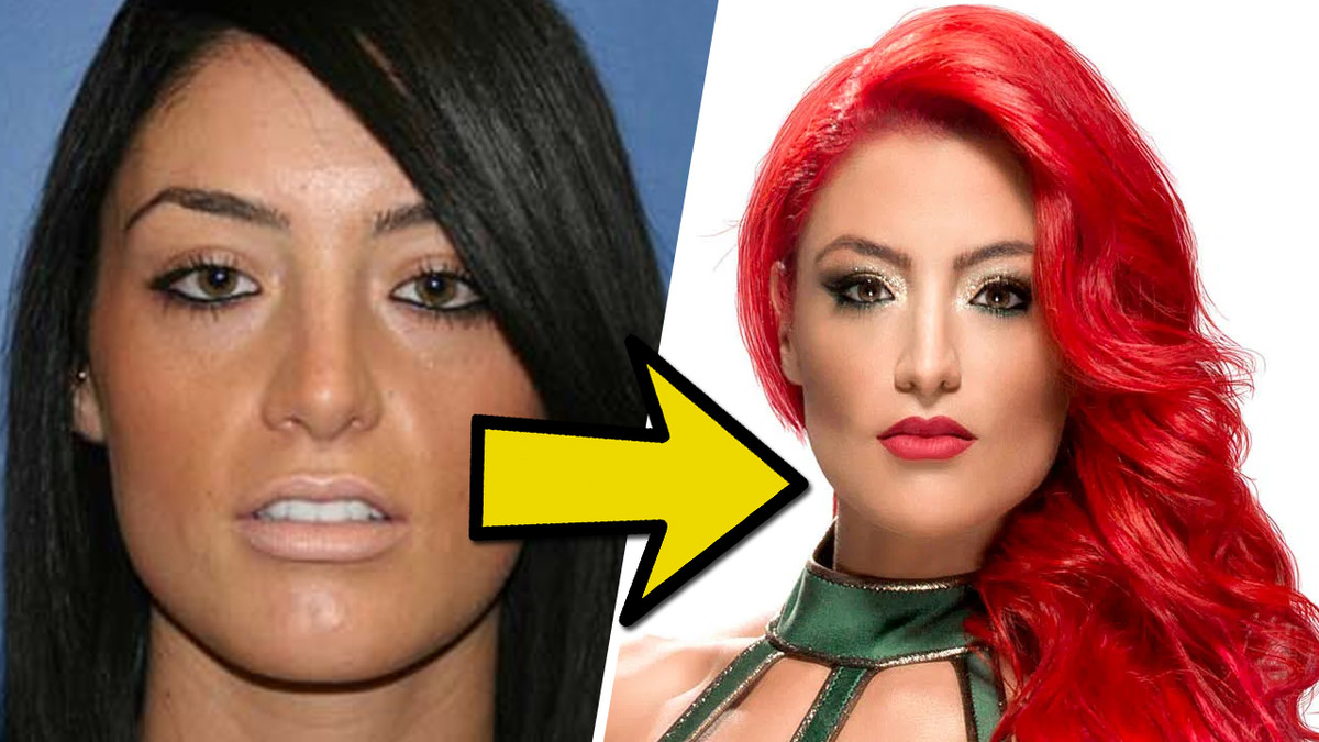 10 Ways Wrestlers Changed Their Appearance Through Surgery – Page 2